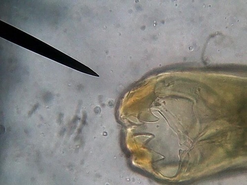 Ancylostoma Duodenale Inaturalist United Kingdom