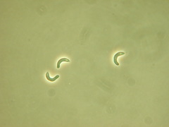 Ceriporia purpurea
