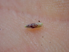 Benitoa occidentalis