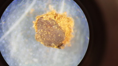 Placidium squamulosum