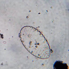 Surirella striatula