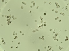 Saccharomyces paradoxus