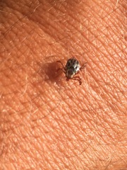 Dermacentor andersoni