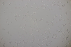 Botryobasidium subcoronatum