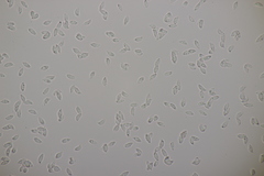 Botryobasidium subcoronatum