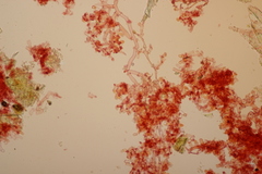 Botryobasidium subcoronatum