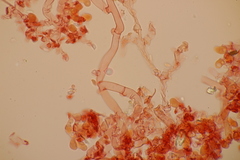 Botryobasidium subcoronatum