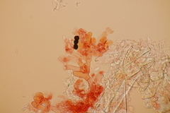 Botryobasidium subcoronatum