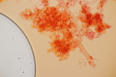 Botryobasidium subcoronatum