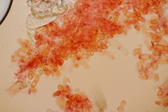 Botryobasidium subcoronatum