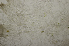 Bryoscyphus phascoides