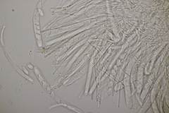 Bryoscyphus phascoides