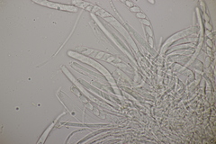 Bryoscyphus phascoides