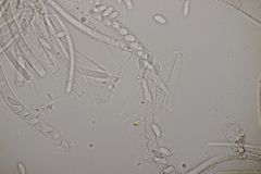 Bryoscyphus phascoides