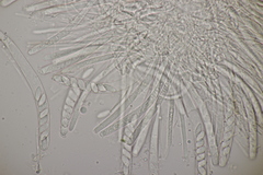 Bryoscyphus phascoides