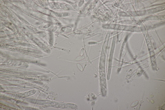 Bryoscyphus phascoides