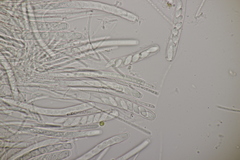 Bryoscyphus phascoides