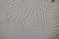 Bryoscyphus phascoides