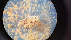 Placidium squamulosum