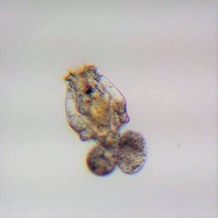 Brachionus angularis