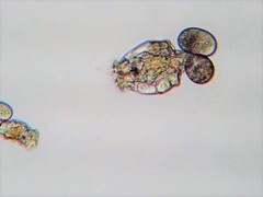 Brachionus angularis