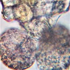 Brachionus angularis