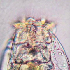 Brachionus angularis