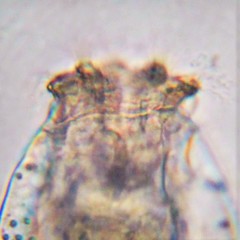 Brachionus angularis