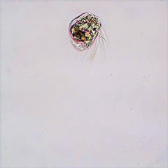 Polyarthra dolichoptera