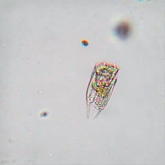 Polyarthra dolichoptera