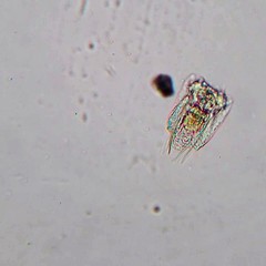 Polyarthra dolichoptera