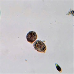 Polyarthra dolichoptera