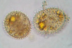 Polyarthra dolichoptera