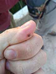 Amblyomma