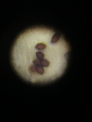 Lacrymaria lacrymabunda