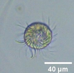 Strobilidium