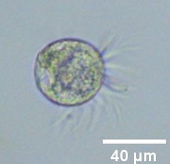 Strobilidium