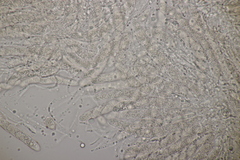 Phyllachora graminis