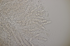 Phyllachora graminis