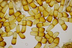 Puccinia sessilis