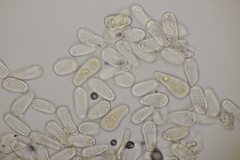 Melampsoridium hiratsukanum
