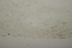 Melanoleuca brevipes