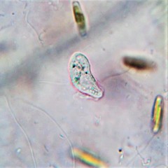 Philasterides