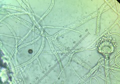 Aspergillus fischeri