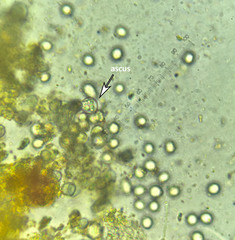 Aspergillus ruber