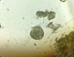 Aspergillus ruber