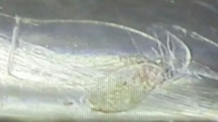 Chelophyes appendiculata