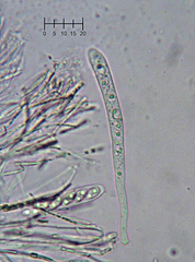 Ascocoryne lilacina
