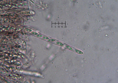 Ascocoryne lilacina