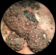 Hypoxylon perforatum